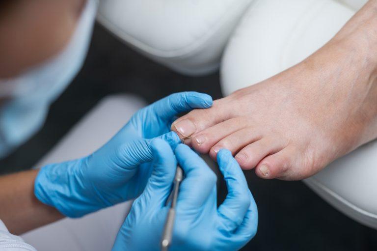 Routine Foot Care Louisa Seymour Podiatry